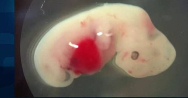 Itt van az első hibrid embrió (emberből és sertésből), amit szervdonornak növelnek a laborokban! - VIDEÓ