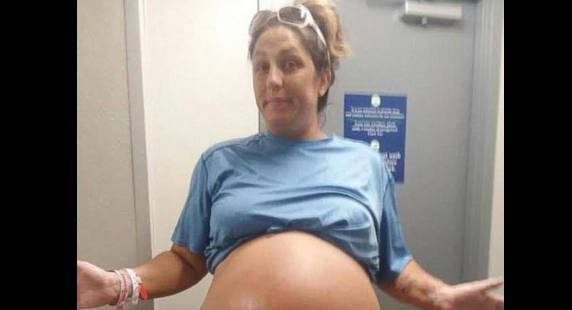 Amikor a nő megmutatta a hasát, az orvosok hangosan nevetni kezdtek, – de amikor meglátták a kisbabát, alig kaptak levegőt!