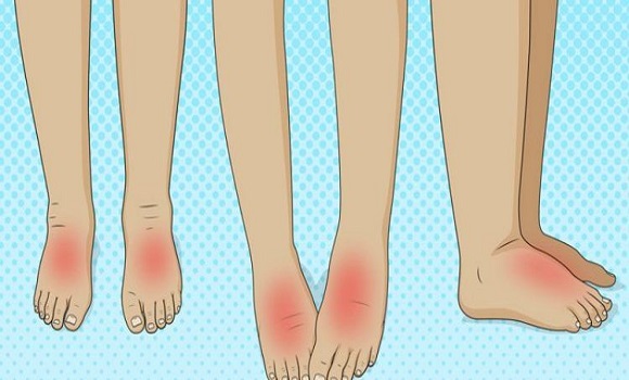 11 figyelmeztető egészségügyi állapot, amely lábduzzanatot okozhat