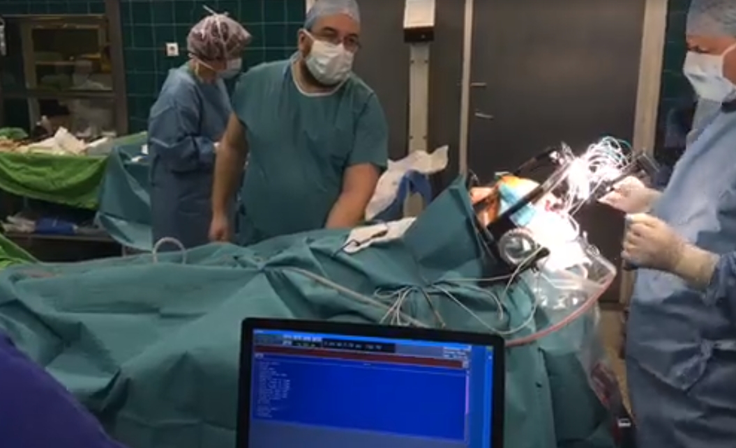Lezajlott az első olyan magyar agyműtét, amelyet a Facebookon közvetíthettünk élőben