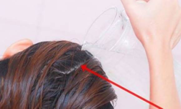 A hajtöveknél zsírosodik a te hajad is? Néhány perc alatt örökre megoldódik a problémád ezzel a trükkel!