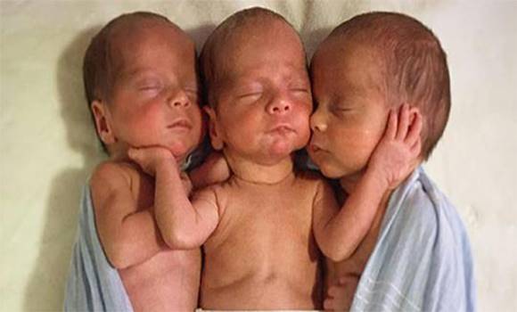 Hármas ikreknek adott életet. Amikor az orvosok meglátták az arcukat, egyből lefagytak