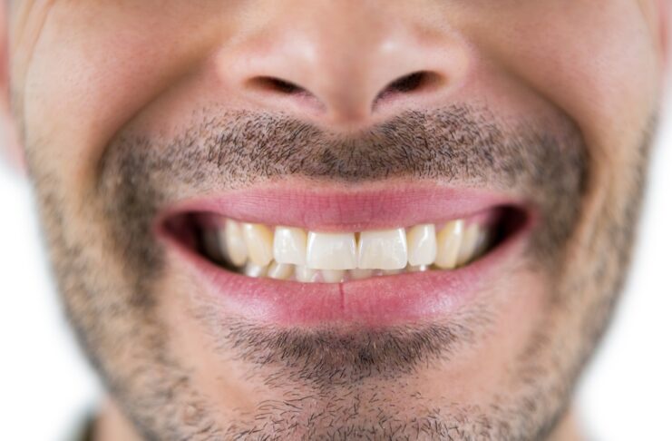 man showing his teeth